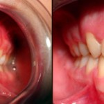 Caso 1 - Ortodontia