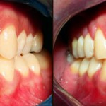 Caso 2 - Ortodontia